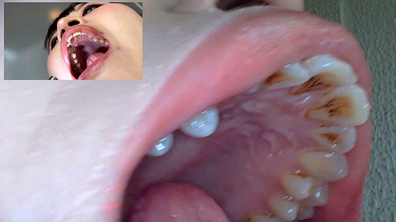 「【素人ナンパ】コールセンター勤務の美人お姉さんに街角で声かけ!口内観察に恥じらう姿が可愛すぎる」のサンプル画像16枚目