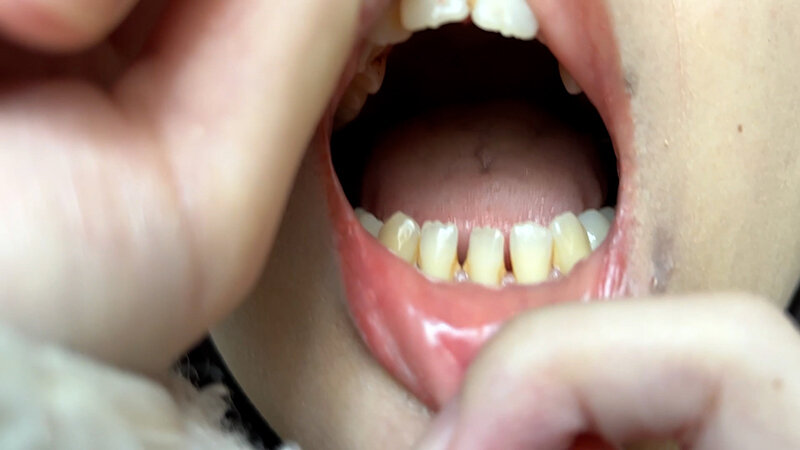 「【素人ナンパ】コールセンター勤務の美人お姉さんに街角で声かけ!口内観察に恥じらう姿が可愛すぎる」のサンプル画像6枚目