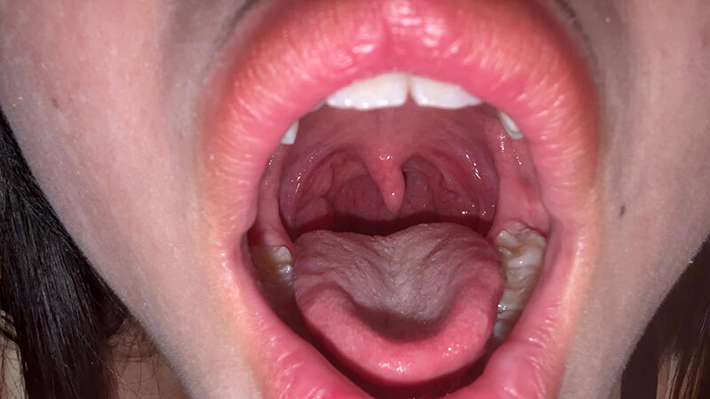 「【七藤優亜】超長舌お姉さんの開口器観察プレイ|素人個人撮影で魅せる濃厚舌技」のサンプル画像5枚目