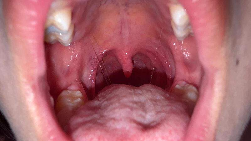 「【七藤優亜】超長舌お姉さんの開口器観察プレイ|素人個人撮影で魅せる濃厚舌技」のサンプル画像6枚目