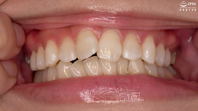 「【谷田かりな】口内観察&巨大女フェチ動画!歯・口腔フェチ必見のくすぐったがり反応【フェチ】」のサンプル画像3枚目