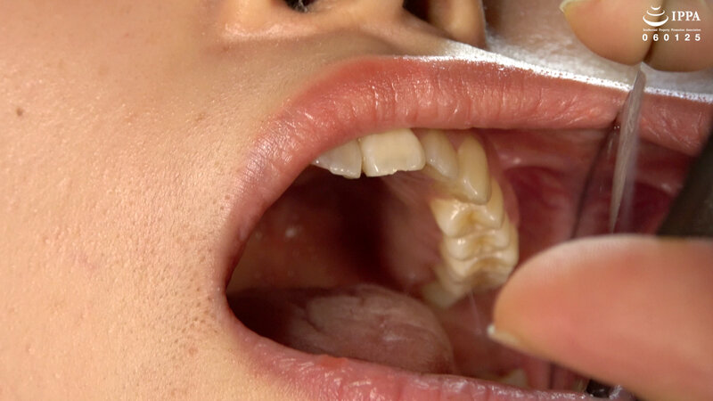 「【江澄ゆゆ】美少女M女の口内・のどちんこ観察！激レア接写で魅せる歯フェチ動画」のサンプル画像10枚目