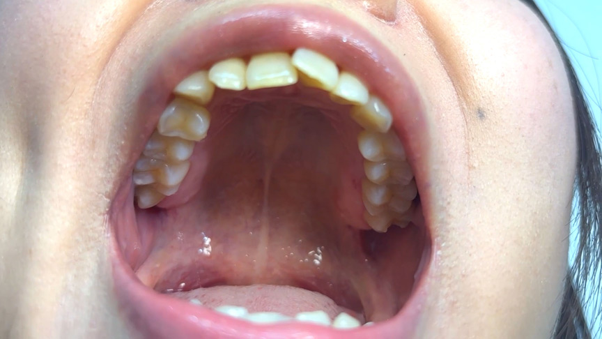 「【素人AD】みゆりちゃんの口内観察プレイ｜街角ナンパ企画で歯・舌・喉をじっくり撮影【フェチ動画】」のサンプル画像4枚目