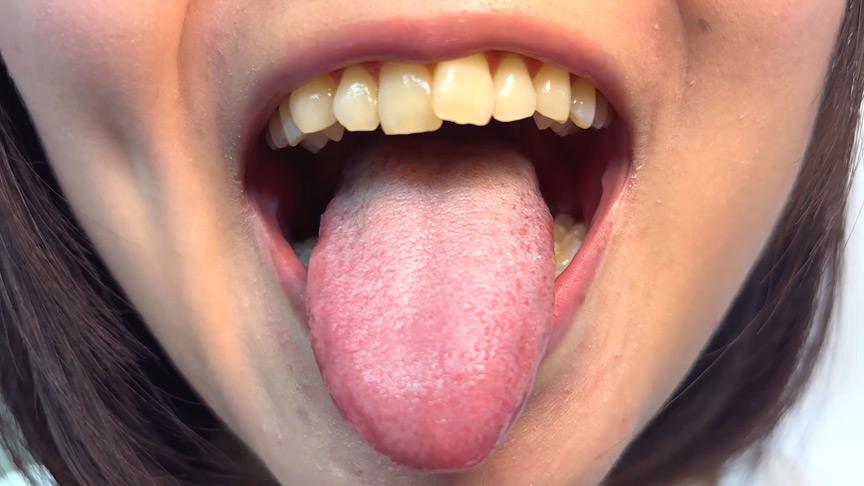 「【素人AD】みゆりちゃんの口内観察プレイ｜街角ナンパ企画で歯・舌・喉をじっくり撮影【フェチ動画】」のサンプル画像7枚目